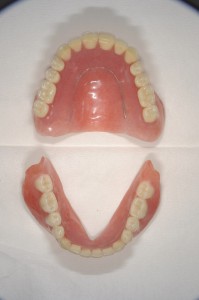 ダイナミック印象による義歯 (3)
