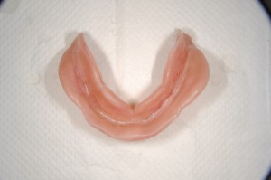 ダイナミック印象による義歯 (8)