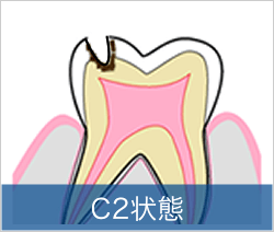 C2状態