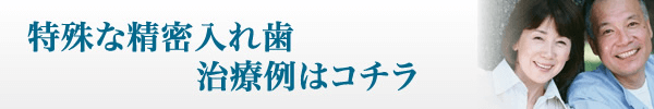 特殊な精密入れ歯治療入れ歯はコチラ