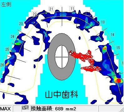 術前