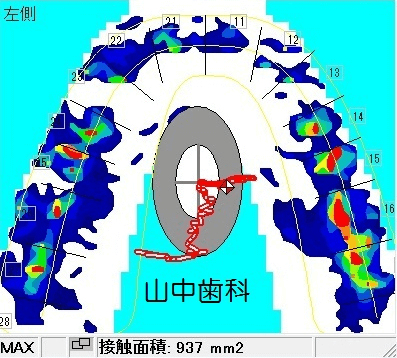 術直後