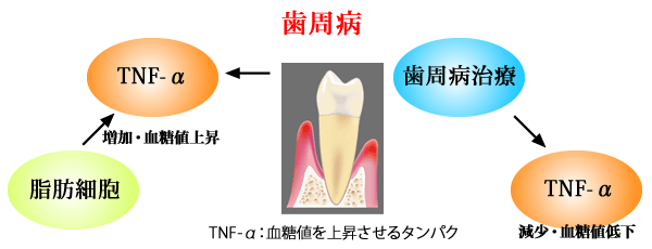 引用：日本臨床歯周病学会